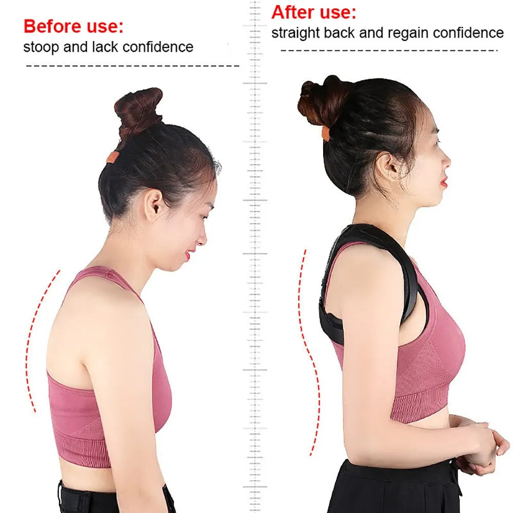 Adjustable Posture Corrector