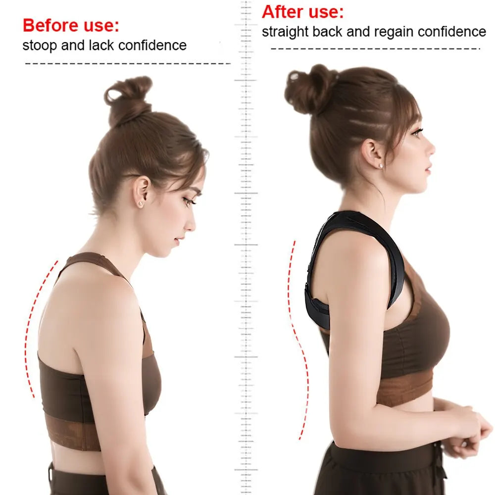 Back Posture Corrector